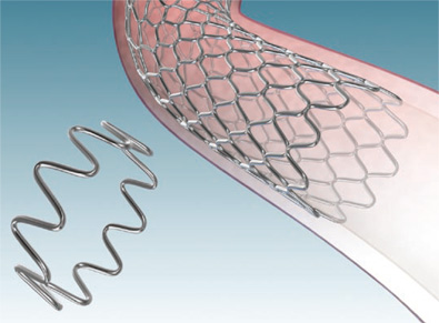 Medtronic Stents