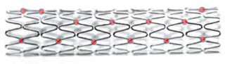 Thin Struts