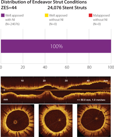 Distribution of Endeavor Strut Conditions