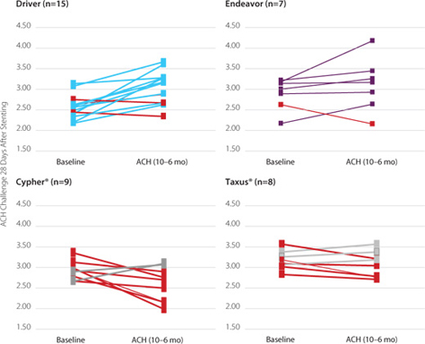 Positive Acetylcholine Challenge Response